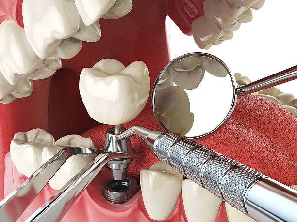 Best Emergency Broken Tooth Repair in White Oak, MD